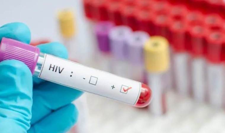 HIV erken teşhis ve tedaviyle “yönetilebilir” bir hastalık