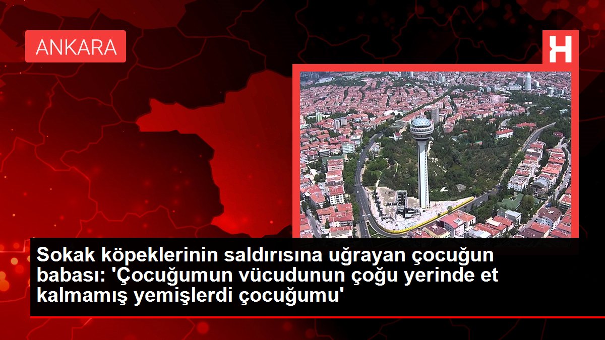 Sokak köpeklerinin saldırısına uğrayan çocuğun babası: ‘Çocuğumun bedeninin birçok yerinde et kalmamış yemişlerdi çocuğumu’