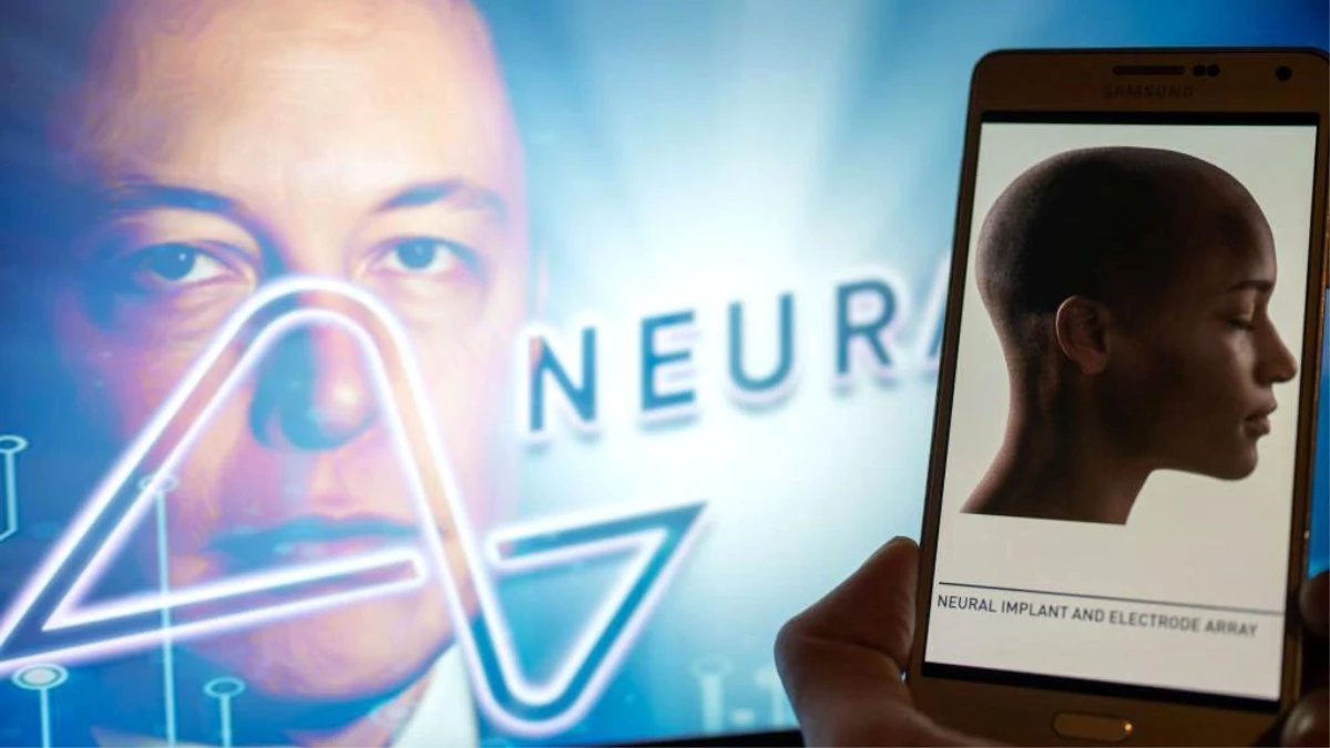 Elon Musk, Neuralink projesinde yeni bir etaba ulaştıklarını duyurdu